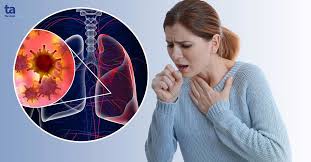 Ung thư phổi – Nguyên nhân, triệu chứng và phương pháp điều trị hiệu quả